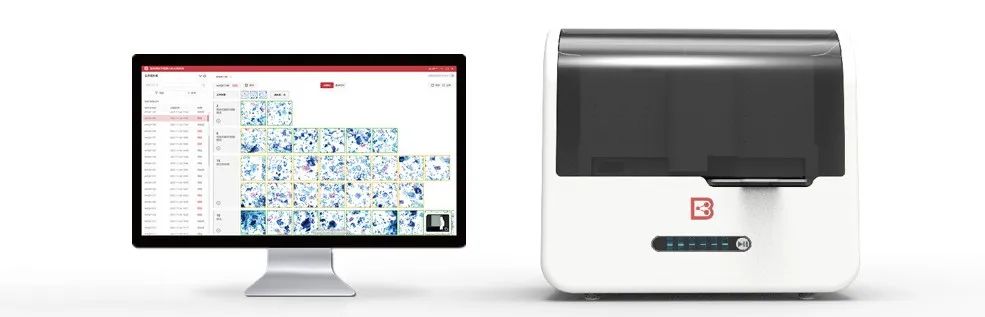 安必平一季度研发投入大增143%，病理图像分析软件成功上市